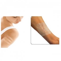 Steri-Strip 12x100mm 3M