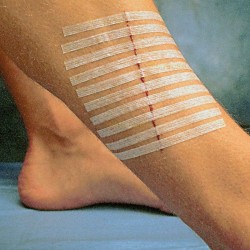 Steri Strip  6x100mm (Package of 10 pcs) 3M R1546